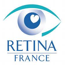 retina_france_1.jpg
